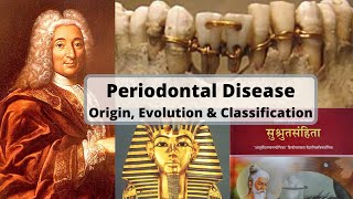 PERIODONTAL DISEASE  Origin Evolution and Classification [upl. by Edualc]