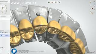 3shapeComplete Denture full mouth Design [upl. by Rodmun]