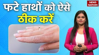 Best Tips for dry skin in winter  फटे हाथों को घर पर ही ऐसे ठीक करें  Healthy Nation  EP35 [upl. by Yhtomit849]