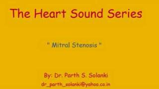 Mitral Stenosis  Sound [upl. by Liahcim]