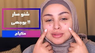 شنو صار بوجهي  وشلون بتمكيج و أغطيه 😰 [upl. by Gwendolen]