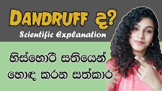 Dandruff Treatment Sinhala ⏐ How to cure Dandruff ⏐ හිස්හොරි නැති කරන ක්‍රම [upl. by Josefina]