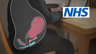 How and when should I do pelvic floor exercises  NHS [upl. by Alejandro783]