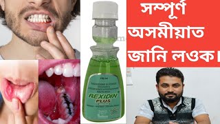 REXIDIN PLUS Mouthwash  Antiseptic  Anticaries Solution [upl. by Anirret978]