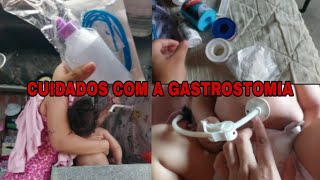 A GastrostomiaAdaptação do banho🥺 [upl. by Nivak]