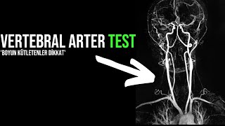 VERTEBRAL ARTER TESTİ [upl. by Annirak]