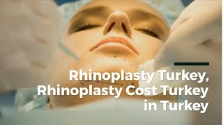 Rhinoplasty Cost in turkey Nose Job Surgery in Turkey [upl. by Ruperto538]