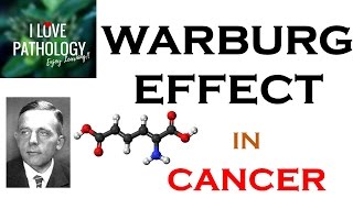 NEOPLASIA 6 WARBURG EFFECT Hallmark of CANCER What Why amp How [upl. by Gregoor]