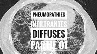 Pneumopathies Infiltrantes Diffuses  partie 01 Définition [upl. by Hawley607]