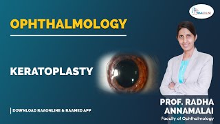 Ophthalmology  Keratoplasty  Raaonline ophthalmology ophthalmologists ophthalmology [upl. by Dunlavy]