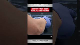 Dont Go Too Deep with IV Cannulation  shorts ivcannulation anesthesiology nurse [upl. by Nyledam]