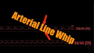 The New York Times quotHardquot Sudoku Hidden Triples aka The Three Line Whip [upl. by Burny]