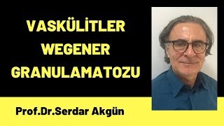 Romatoloji Vaskülitler Wegener Granulamatozu [upl. by Anayia52]