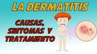 LA DERMATITIS Causas signos y síntomas diagnóstico y tratamiento [upl. by Pastelki]