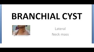 ENT Branchial Cyst Sinus Fistula Lateral neck mass [upl. by Rubliw]