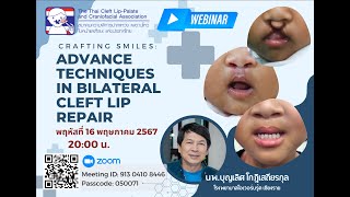 THaiCleft webinar 22567Bilateral cleft lip repairDr Boonlerz [upl. by Agneta]