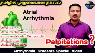 Atrial Arrhythmia in tamil  Atrial ectopic supraventricular Tachycardia SVT Flutter fibrillation [upl. by Abekam]