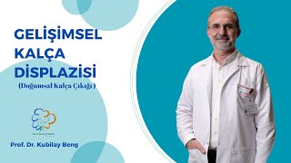 Gelişimsel Kalça Displazisi Doğumsal Kalça Çıkığı Nedir [upl. by Eellek]