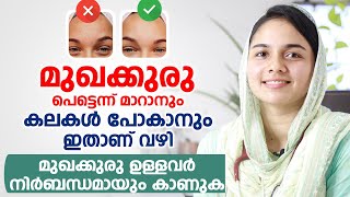 മുഖക്കുരു Acne Pimples പെട്ടെന്ന് മാറാനും കലകൾ പോകാനും ഇതാണ് വഴി [upl. by Ahsaeit]