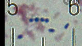 bacteria streptococcus thermophilus [upl. by Chrystel624]