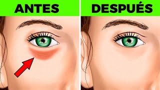 👓18 REMEDIOS FÁCILES PARA ELIMINAR LAS BOLSAS EN LOS OJOS [upl. by Hadihahs]