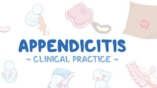 Appendicitis sign symptoms Treatment Homeopathic world [upl. by Eizdnil]