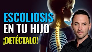 ESCOLIOSIS en niños y adolescentes  Detección temprana y Tratamientos [upl. by Grondin168]