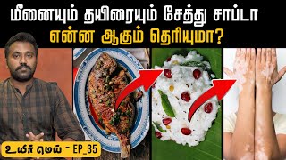 தோல் பிரச்சனை Vitiligo skin explained in Tamil  ஏன் சேர்த்து சாப்பிடக் கூடாது Uyirmei Epi  35 [upl. by Esdnil]