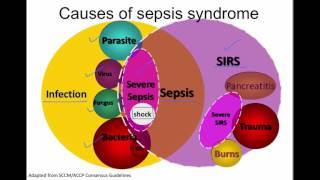 Pathogenesis of sepsis [upl. by Boigie]