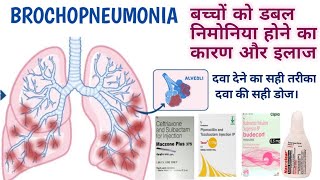 बच्चों में डबल निमोनिया होने का कारण और इलाज  Bronchopneumonia causes and treatment in Hindi [upl. by Marven]