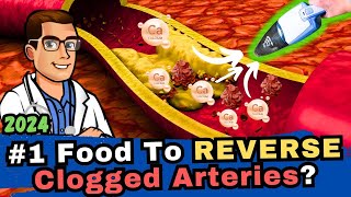 1 Food to Clean out Your Arteries Blood Clots amp Arteriosclerosis [upl. by Yssak]