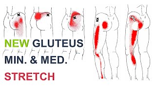 Stretches For Hip And Leg Pain  Gluteus Medius Pain [upl. by Fritze]