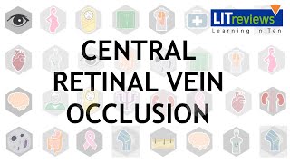 Central Retinal Vein Occlusion [upl. by Stannfield]