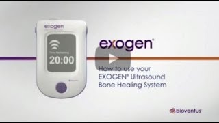 How to use EXOGEN us [upl. by Aynotel]