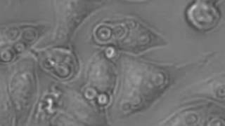 Cryptococcus neoformans migrating between macrophages [upl. by Ykcin]