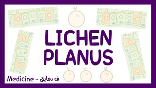 Lichen planus  definition pathophysiology types clinical picture diagnosis amp treatment شرح عربي [upl. by Irme]