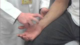 Tinels Test of the Ulnar Tunnel [upl. by Connors41]