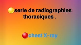 🟥Séries de radiographies thoraciques 🟫Chest x ray [upl. by Attelrac]