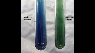 Citrate Utilization Test [upl. by Annelg]