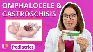 Omphalocele amp Gastroschisis  Pediatric Nursing  LevelUpRN [upl. by Junette193]