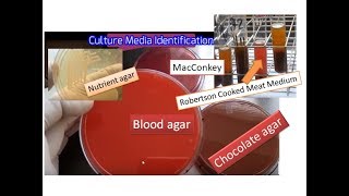 Culture media the simplest way of identification  Blood MacConkey  Chocolate RCM Nurient agar [upl. by Corin565]