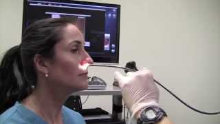 Esophagoscopy Without Sedation TransNasal Esophagoscopy Esophagus Exam Endoscopy [upl. by Oralle576]