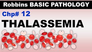 Ch12  Thalassemias  αThalassemia  βThalassemia  Blood Pathology  Dr Asif Lectures [upl. by Notsle]