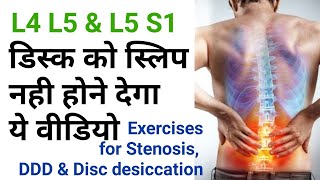 exercises for back pain Disc Dessication stenosis l4l5 l5s1 facet joint by dr sandeep Bhardwaj [upl. by Llenrad]