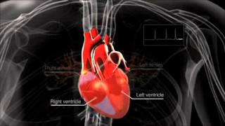 What is atrial fibrillation [upl. by Nuncia]