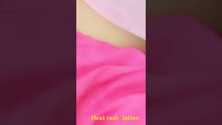 how to treat prickly heat rashes [upl. by Pearce]