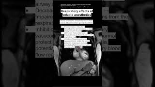 Respiratory effects of volatile anesthetics [upl. by Cyndia809]