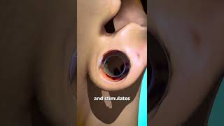 How Ear Gauges Can Tear Your Ears 👂 [upl. by Cybil]