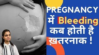 Bleeding In Pregnancy  Pregnancy me Bleeding Kyo Hoti Hai  Dr Mayuri Kothiwala Jaipur [upl. by Coltin844]