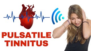 Pulsatile Tinnitus  Why You Shouldnt Ignore It [upl. by Tlaw]